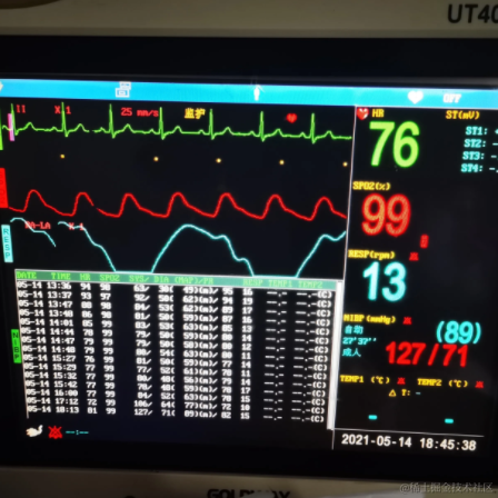 麒麟改bug于2021-05-19 17:06发布的图片