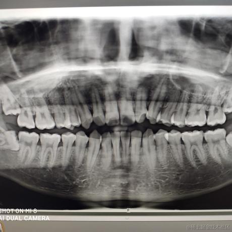 晚宝碗宝于2022-11-29 19:29发布的图片