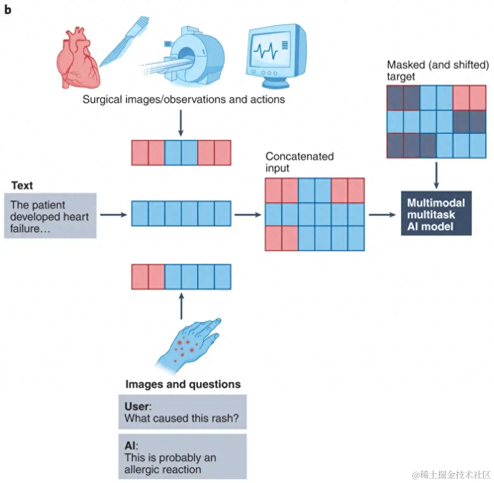 多模态生物医学人工智能研究 (Acosta 等，Nature Medicine 2022).png